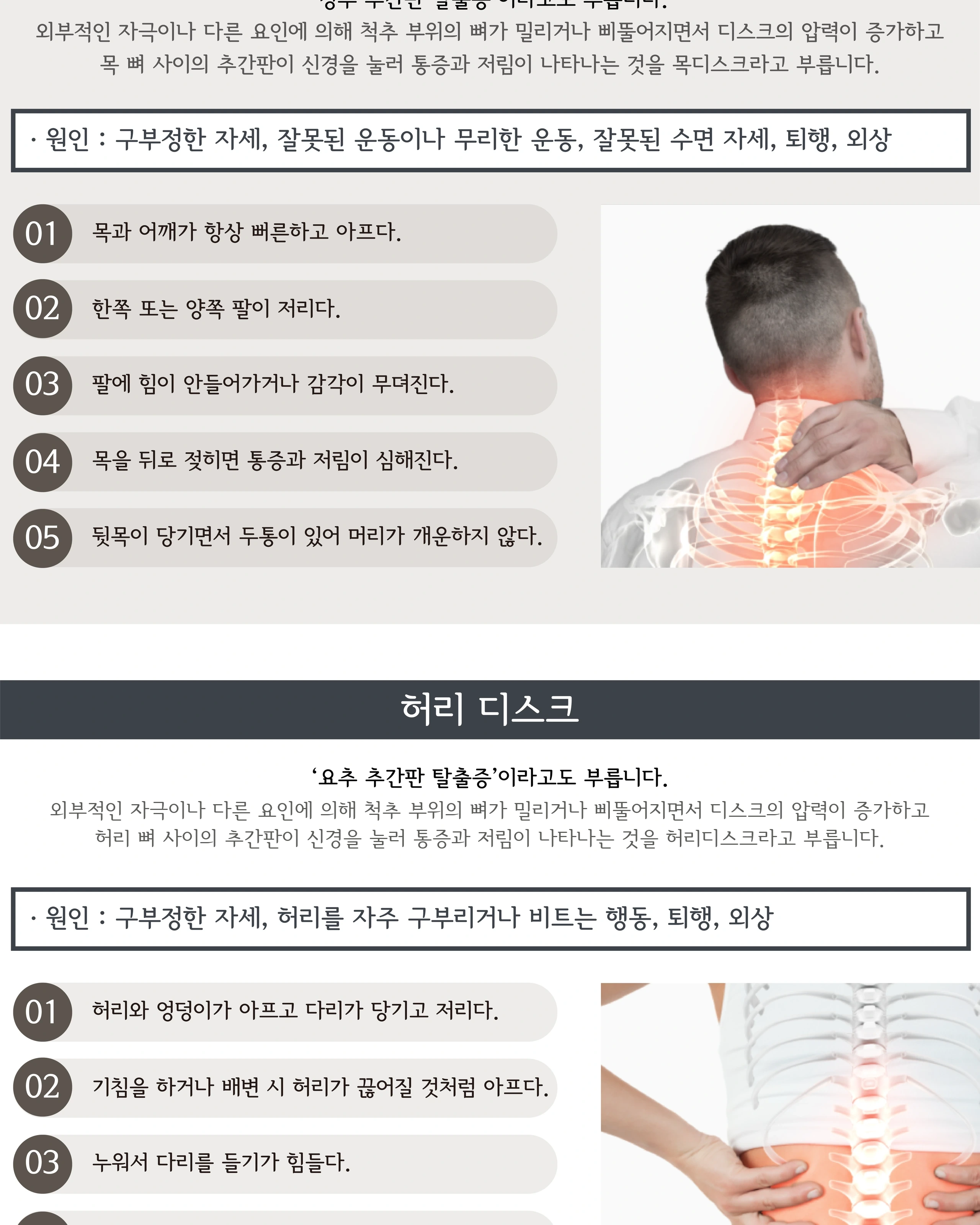 목디스크·허리디스크의 설명과 증상 안내